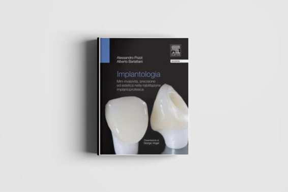 Implantologia: mini invasività, precisione ed estetica nella riabilitazione implantoprotesica